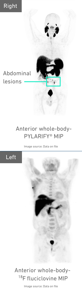 Diagnostic images from the Condor Trial showing abdominal lesions in the human body