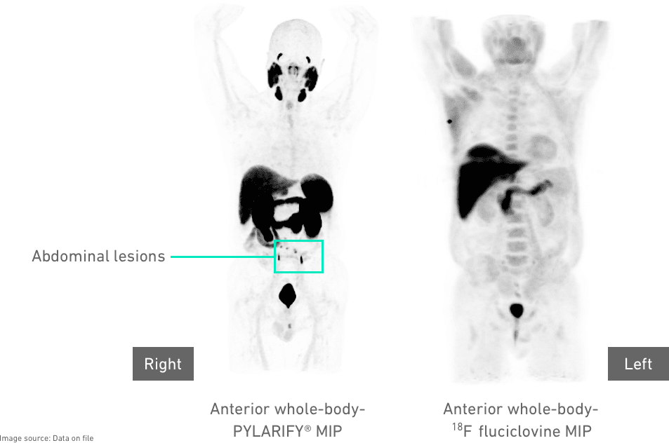 Diagnostic images from the Condor Trial showing abdominal lesions in the human body